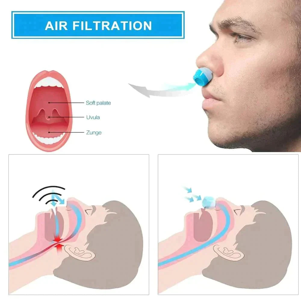 Micro CPAP Sleep Apnea Machine For Travel & Anti Snoring - CPAP Alternative