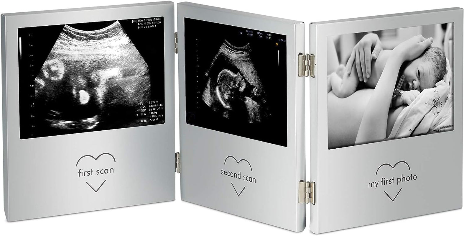 Baby Scan Photo Frame, Multi-Photo Picture Frame for Gender Reveal or Baby Shower, Ultrasound Photo Frame Present for New Mums, Double Hinged Stainless Steel Frame with 3 Photo Apertures